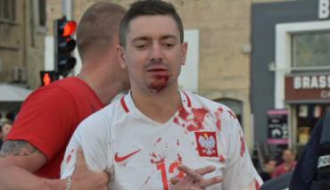 EURO 2016: Polscy kibice zaatakowani przez Albańczyków