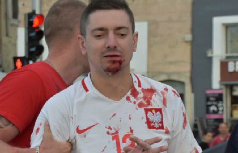 EURO 2016: Polscy kibice zaatakowani przez Albańczyków